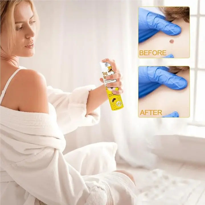 Tag Recede Eliminador De Verrugas + Toenail Plus