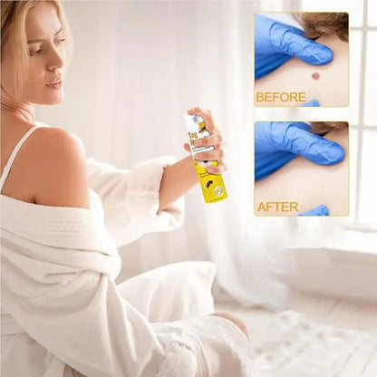Tag Recede Eliminador De Verrugas + Toenail Plus
