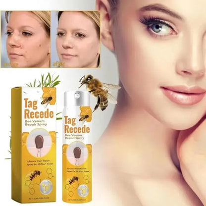 Tag Recede Eliminador De Verrugas + Toenail Plus