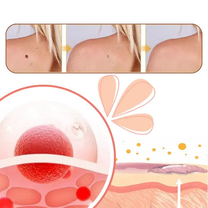 Tag Recede Eliminador De Verrugas + Toenail Plus