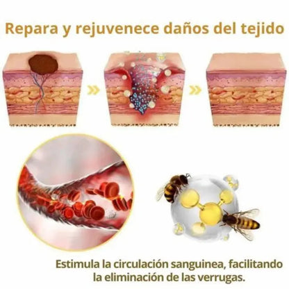 Tag Recede Eliminador De Verrugas + Toenail Plus